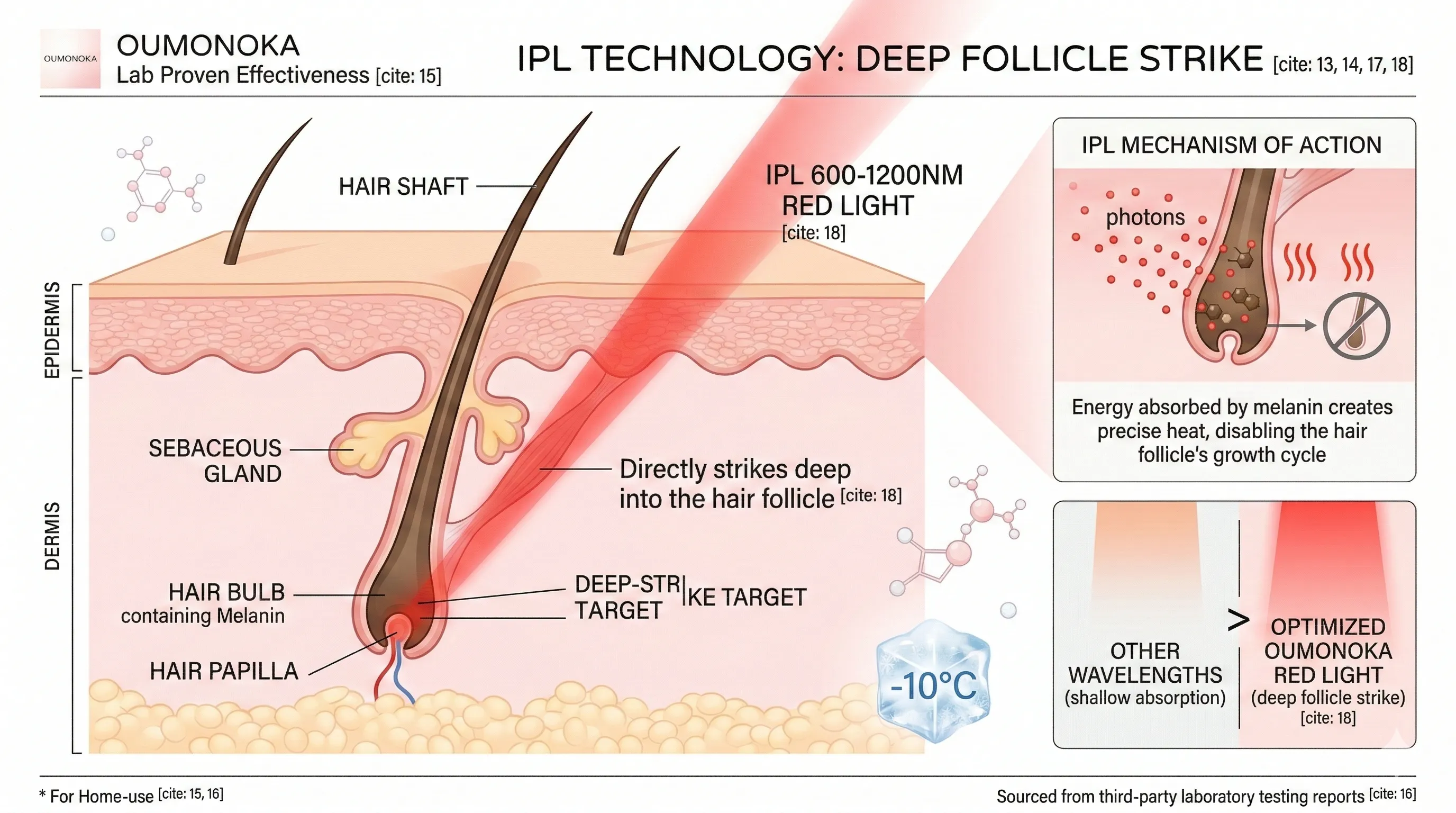 Schéma technologie IPL